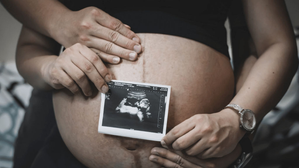 A person holding a photo of their baby