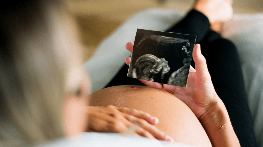 A person holding an ultrasound image of their baby