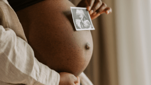 A person holding an ultrasound image of their baby