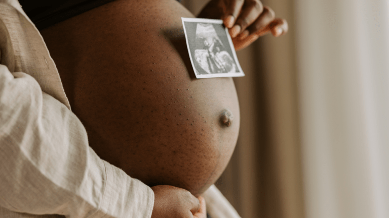 A person holding an ultrasound image of their baby