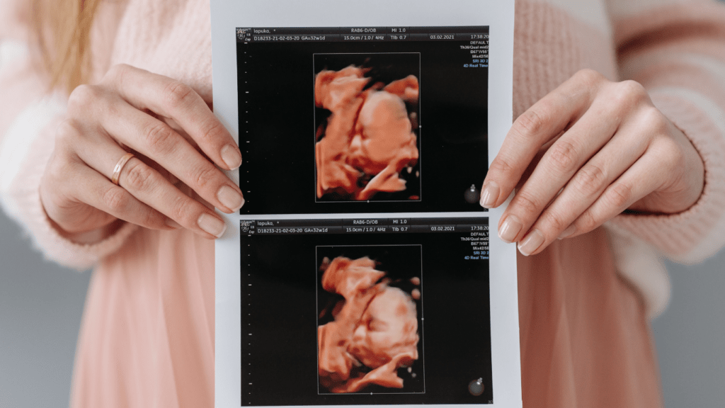 A person holding a photo of their baby